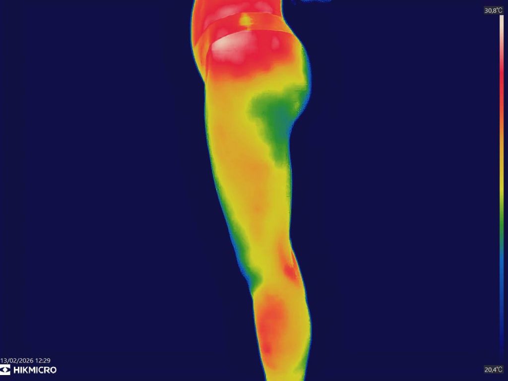 Foto Termografía Deportista