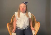 Foto actualizada ADRIANA, SINDROME DE RETT MOLINA OCTUBRE 2026