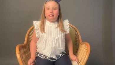 Foto actualizada ADRIANA, SINDROME DE RETT MOLINA OCTUBRE 2026