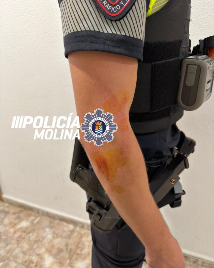 Polícia LOcal Molina de Segura herido imagen de Facebook 855645652_1916540469700175_6138956503042948510_n